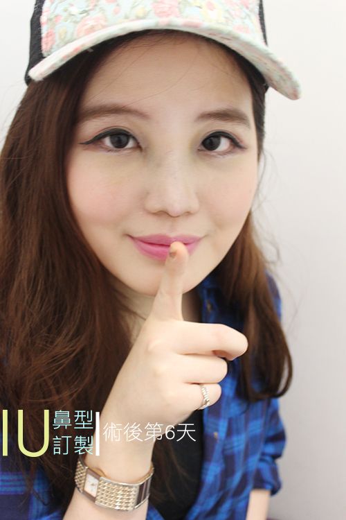 晶美韓式鼻雕，訂製國民妹妹IU小巧鼻型，宛如天生！