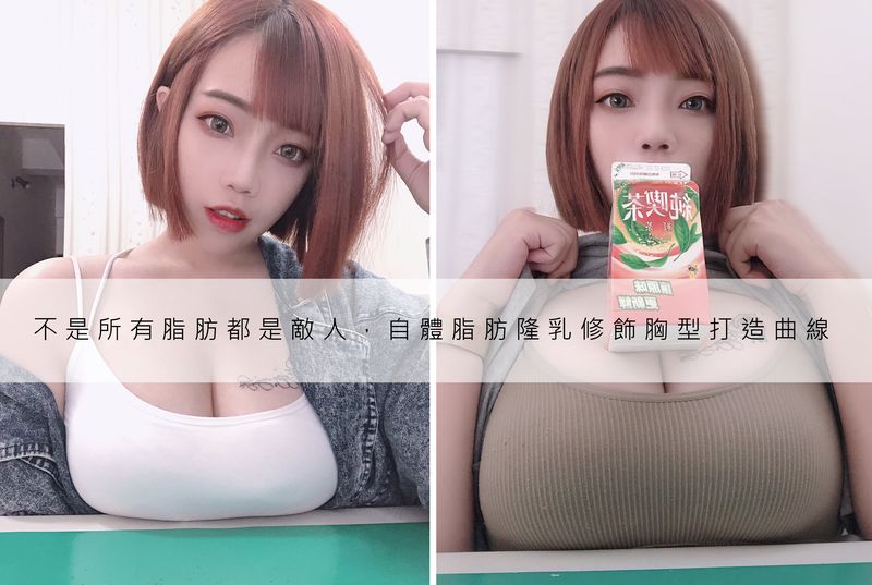 自體脂肪隆乳 脂肪放對就有美胸黃金比例 晶美整形外科