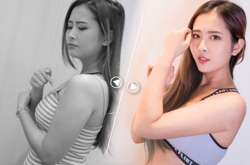 手臂抽脂│晶美整形外科