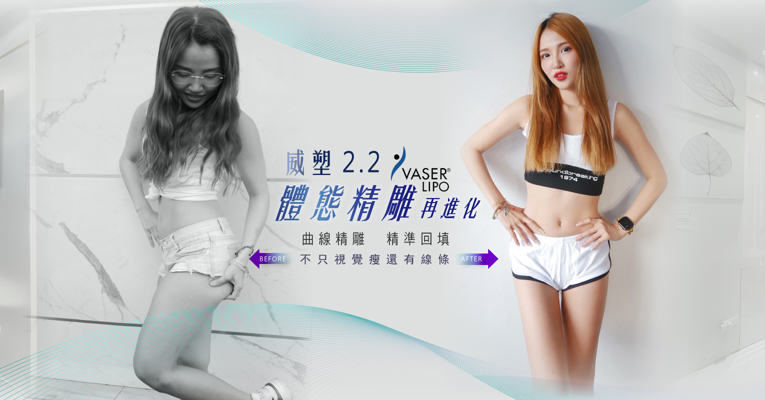 VASER2.2二代威塑抽脂，高存活率的「自體脂肪回填」專利技術，可雕塑理想身體曲線(圖片來源：晶美整形外科)